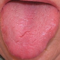 �erven� jazyk zde znamen� p��li� �erven� a odpov�d� horku RE 