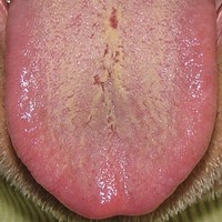 �erven� s povlakem ukazuje na pln� horko RE SHI (St�n brok�tov�ho z�voje - k�d 012)