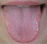 Jazyk zdrav�ho �lov�ka