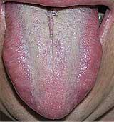 Syt� �erven� jazyk